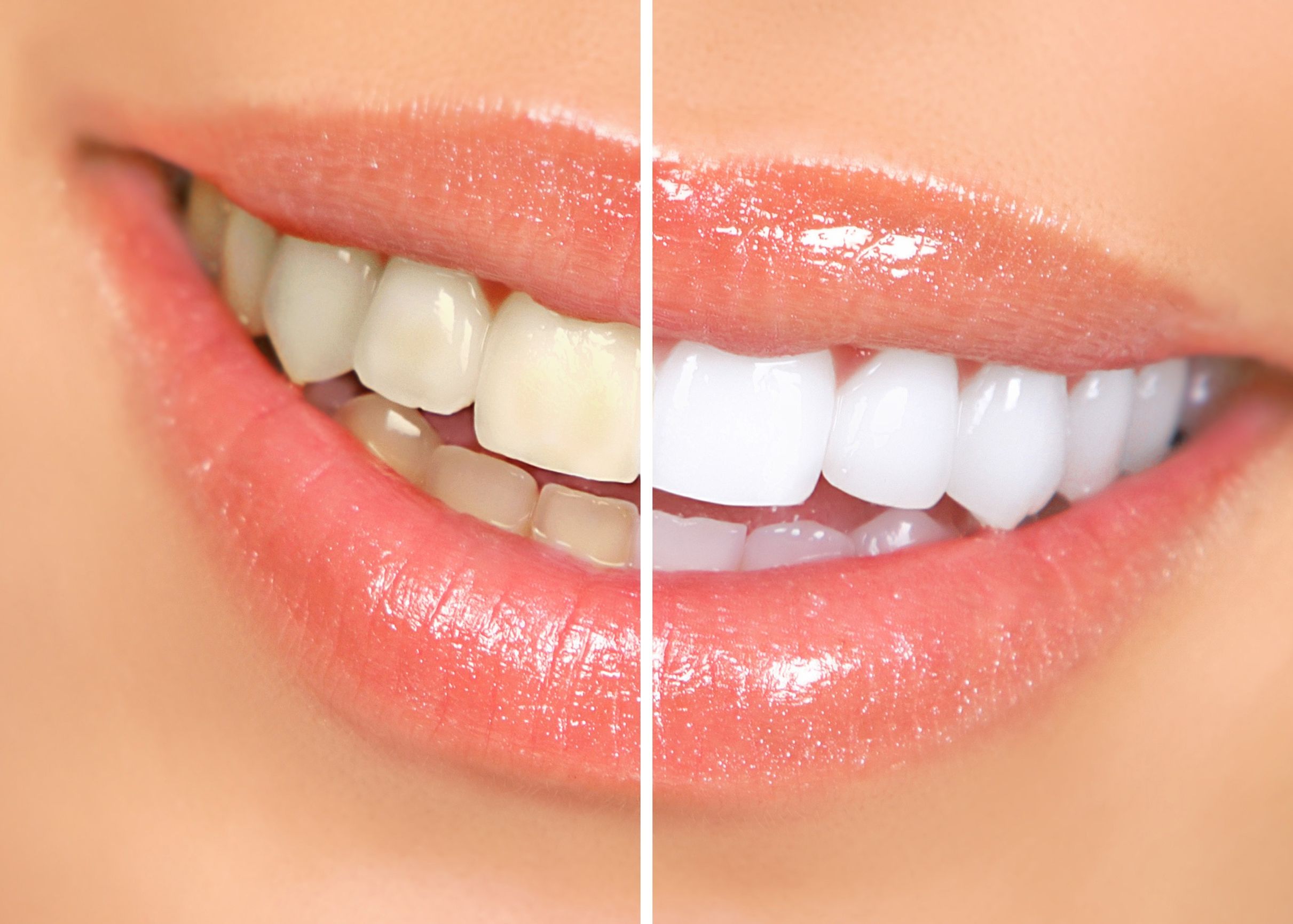 What You Should Know About Cosmetic Dentistry in Bergen County NJ