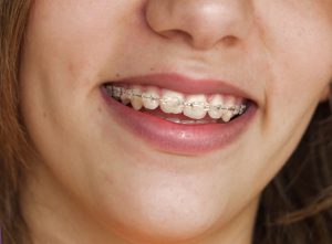 Reasons to Choose a Pediatric Dentist to Care For Your Child’s Teeth