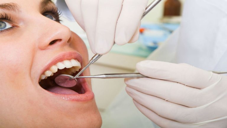 Improve Your Smile With Dental Veneers In Birmingham MI